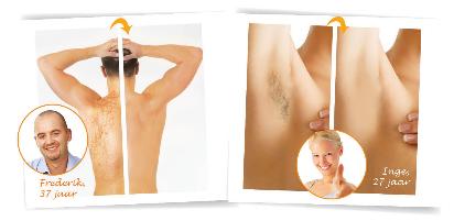 Bij mannen en vrouwen kunnen wij alle zones van het ganse lichaam permanent ontharen met laser Bij mannen en vrouwen kunnen wij alle zones van het ganse lichaam permanent ontharen met laser