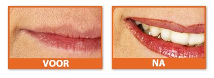 permanente make-up lipcontour permanente make-up lipcontour Hilde van Peer