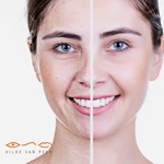 Dankzij Hydrafacial straalt mijn huid opnieuw  blanke brunette met mooie glimlach