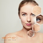 Dankzij Hydrafacial straalt mijn huid opnieuw  blondine met chignon met mooie glimlach